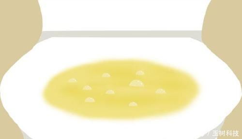 肝功能强的人,早晨身体往往会出现好现象,若全占,恭喜肝很不错