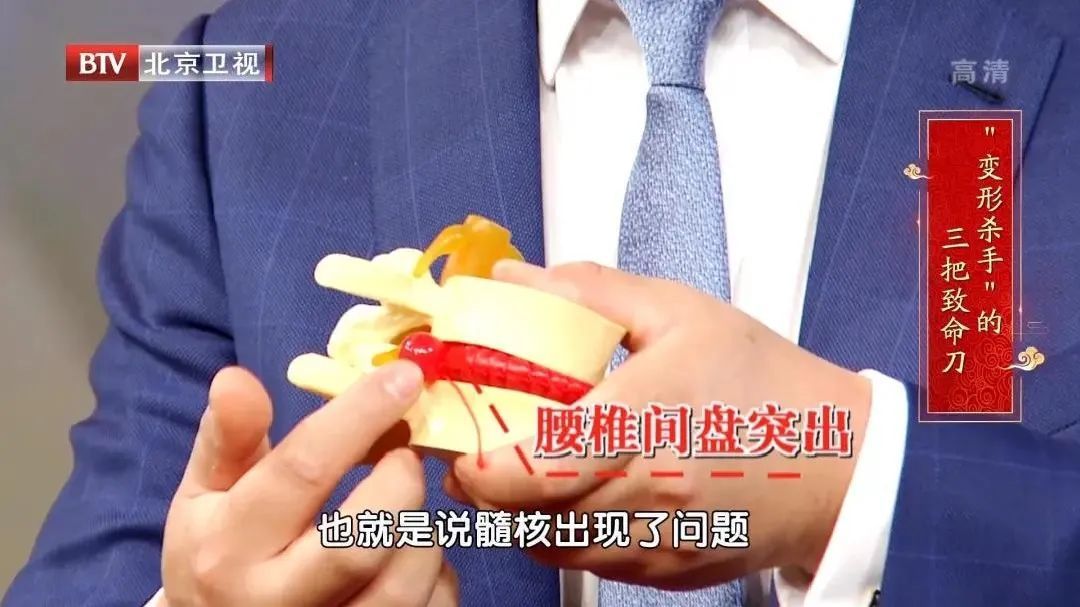 椎间盘|腰椎变形不自知？4个危险信号，1个锻炼方法，快速识别、提前预防~