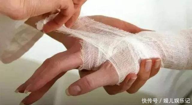 家长|孩子被烫伤,是该先脱衣服还是先冲水?一步做错,孩子伤情更严重