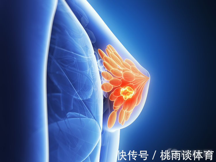 胰腺癌|不瞒你说：最难治愈的癌症中，这5种“榜上有名”