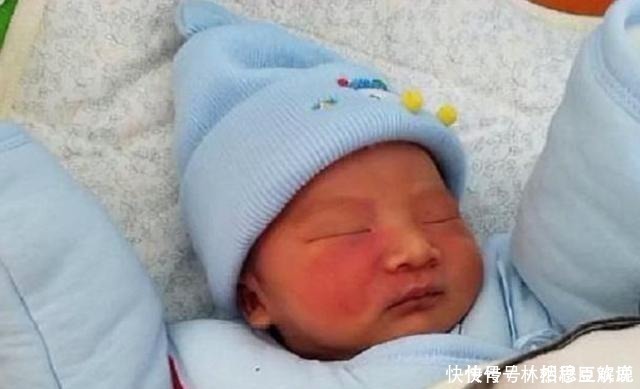 妈妈|胎记咋来的产科医生除了遗传,还与孕期的这3种行为有关