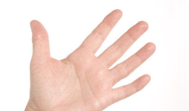 血糖偏高|血糖高不高,看看手就知道,若没三种表现,血糖还算稳定,恭喜