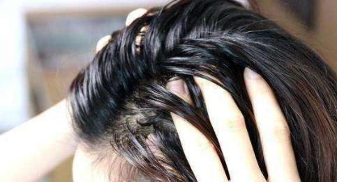 专家|头发爱出油,究竟是福是祸?专家给出了“正解”!