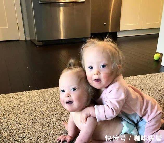 21三体综合症|外国宝妈不顾反对生下“唐氏宝宝”,网友坦言:都有一个共同点!