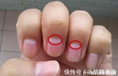 不良习惯|没有妇科疾病的女人,手上有4个特征,你若占1个,子宫很健康