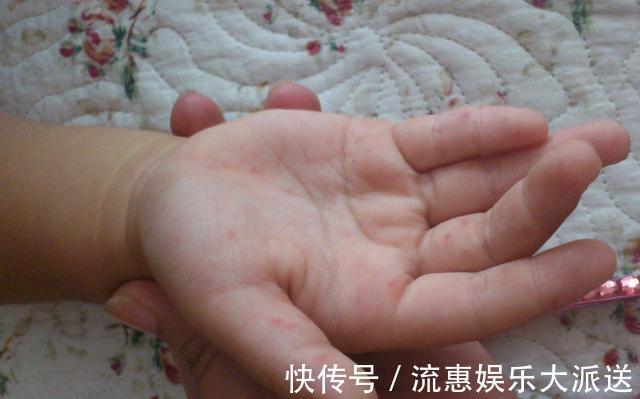 智商|孩子聪不聪明,从手上就能看出门道,智商高的信号都在手上