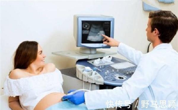 检查|怀孕期间除了6大产检,还要注意这几样东西,各位宝妈快收下