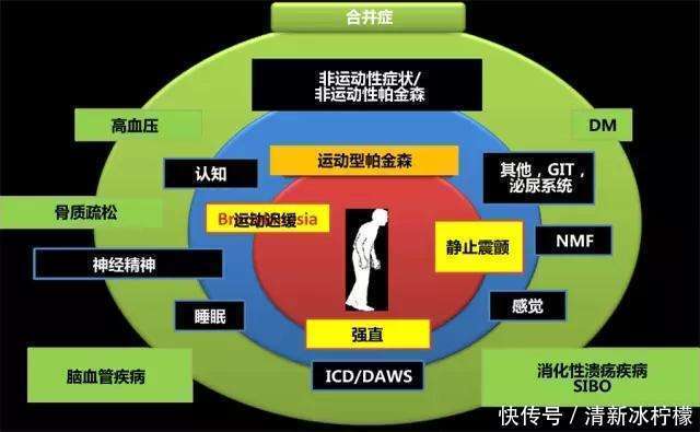  症状|帕金森初期怎么治疗？