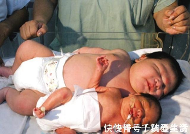 巨大儿|一张图带你看,出生时5斤和8斤的娃大小差异多大!心疼下孕妇吧