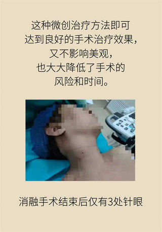 结石|泌尿系统结石为啥要查甲状腺？听听专家怎么说