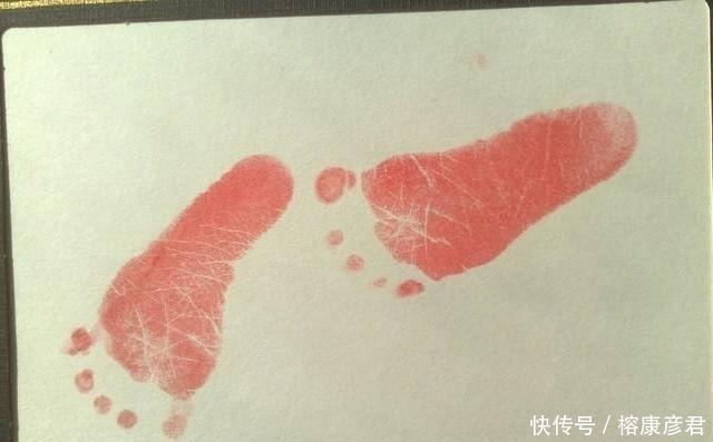 新生儿|新生儿出生为什么要被留脚印?医生不告诉,可父母要知道