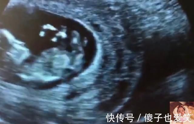 晨练|除了睡觉,胎儿如何每天在肚子里都干啥宝宝小日子开心到飞起