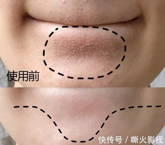 碱性食物 女性过了45岁不要太节俭,多吃5种碱性食物,加一护肤抗衰老