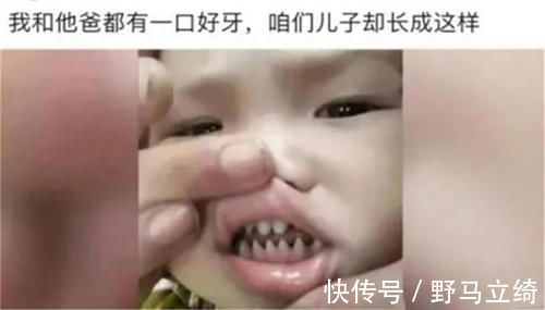 乳牙|儿子长了一口“鲨鱼牙”,妈妈连忙送医,医生无知害了孩子