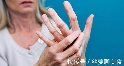关节炎|不论男女，手上若有这种表现，小心类风湿性关节炎“找上门”！