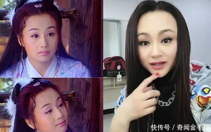 脸上打“玻尿酸”的女孩子之后怎样了?听美容专家一说全明白