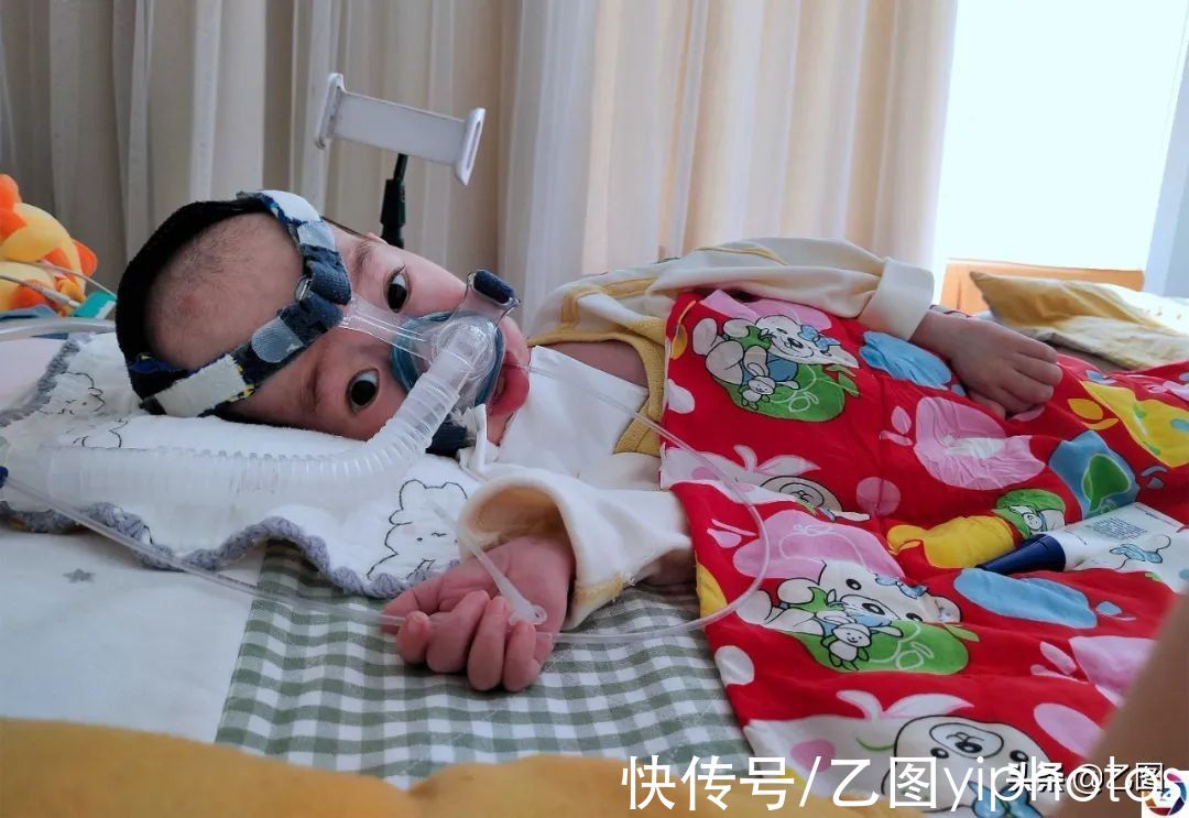 人民医院|两岁男童患SMA，全身只有眼睛手指能动，器官退化瘦成“骷髅架”