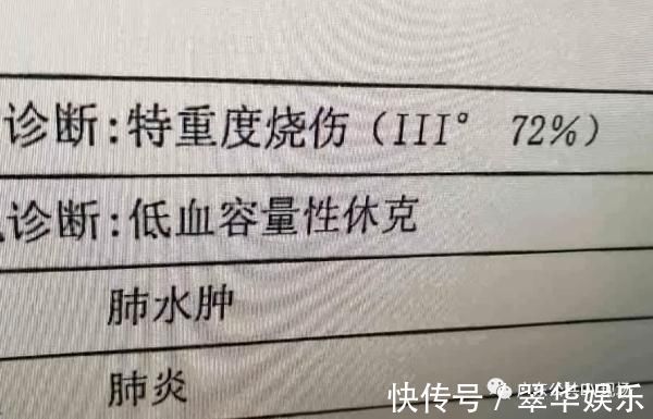 刘女士|女童掉进洗澡水被大面积烫伤，医生：牢记这5个字可救命