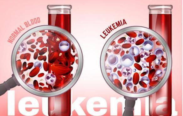 甲状腺|甲状腺癌术后会不会复发？就看这两个指标！