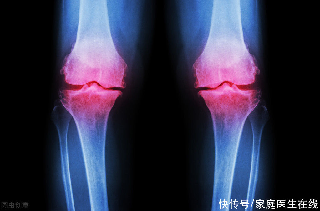  中老年人|中老年人总感觉关节疼痛是怎么回事？大多与这5种疾病有关，早知道早预防