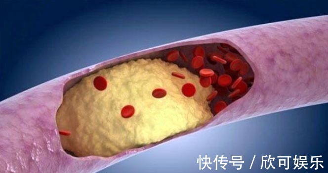 菱角|患有糖尿病之后,以下7种食物不要吃,不然容易造成血糖上升