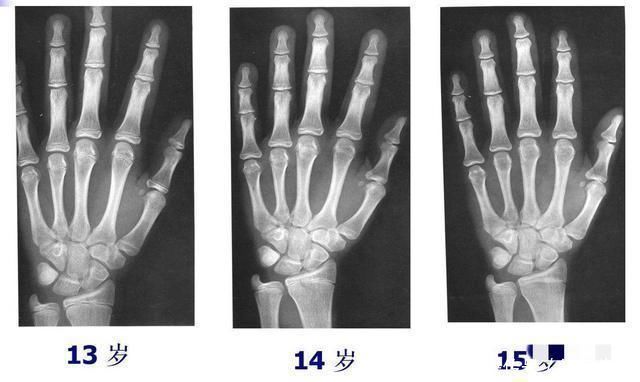 孩子|拥有4个特质的男孩，大多是发育晚，父母无需担心他长不高