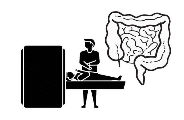 共性|肠癌不是突然发生！患上肠癌的人，有4个共性，占一个也要注意