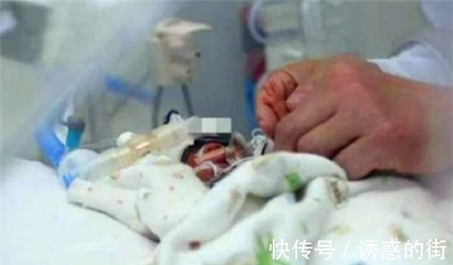 女婴|18年了,那个出生仅280克,曾打破世界纪录的女婴,如今已认不出