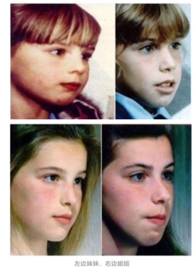 牙齿|牙齿三个 “关键期” ,千万别错过!否则毁掉孩子一口好牙