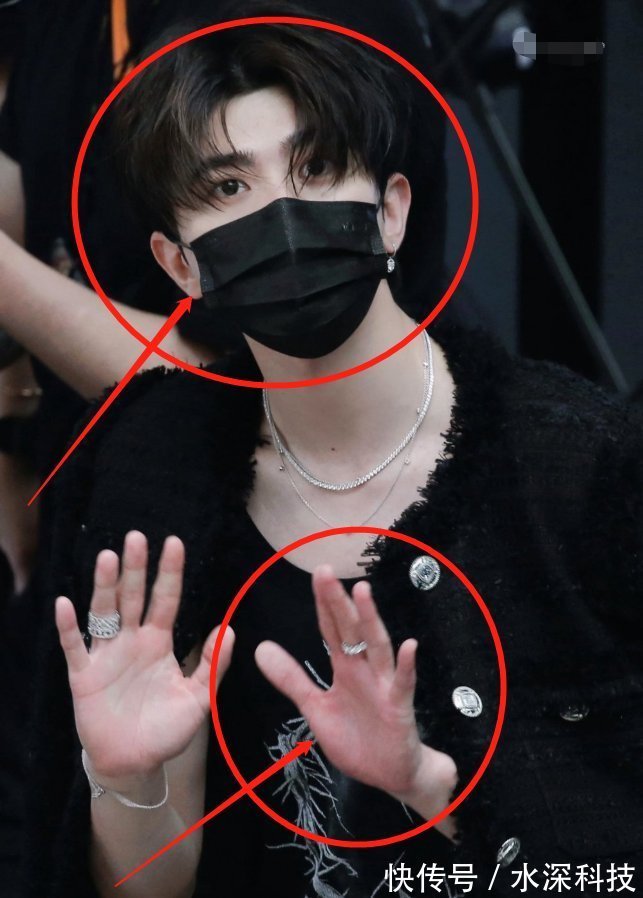 跑男|蔡徐坤参加跑男,大夏天穿羽绒服引关注,手臂上的红疹却让人心疼