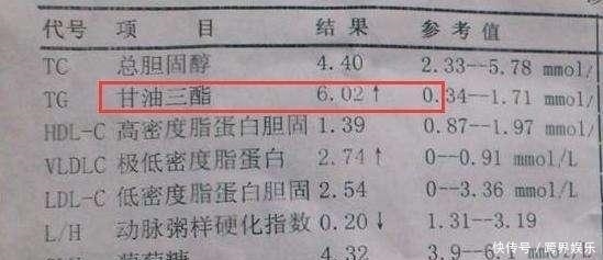 甘油三酯偏高,3种食物需“忌口”,若你爱吃,血管或加速变堵