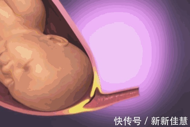 开十指|顺产到底有多疼3张图让你一目了然,妈妈太不容易,请善待她们