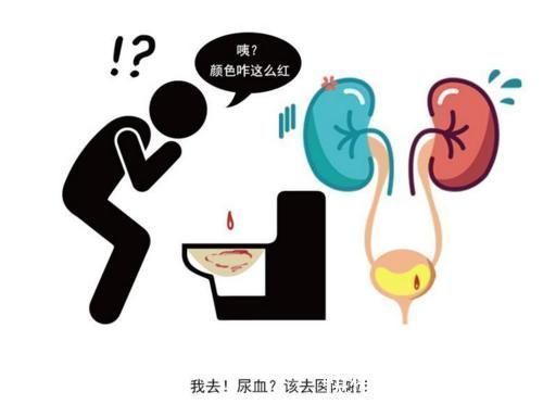 泡沫|尿液是疾病的“报警器”，如果出现4种迹象，尽快去医院检查一下