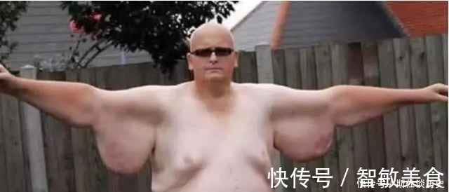 纪念品|吉尼斯之最：第二项“最强女儿奴”，男子减掉500斤肉破纪录