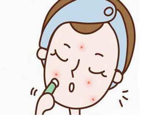 祛痘印做好4个准则,让你努力不白费,干净皮肤指日可待