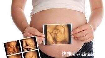 宝妈|孕期做四维有什么好处，什么时候做最好这个时候做是最好的