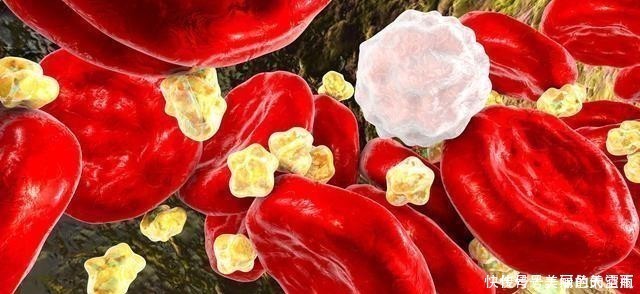 火锅|医生提醒:4件事不改,血脂照样往上涨,别大意