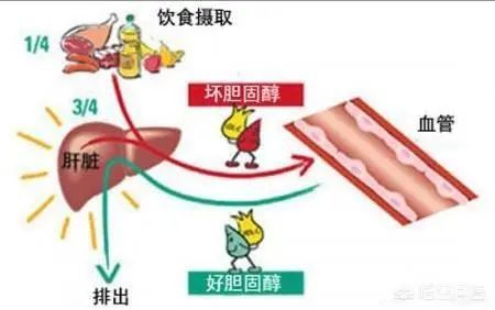运动锻炼|为什么每天坚持运动锻炼，可是血脂就是降不下来？医生告诉您实情