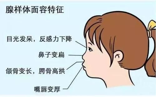 扁桃体肥大|家里有孩子的看过来,宝宝睡觉打呼噜,要引起警惕啦