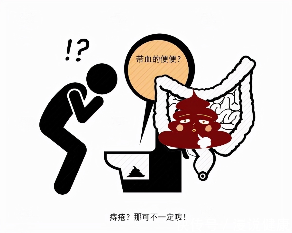 小孙|20岁男子患痔疮全身失血过半:出现这些迹象,务必及时就医治疗