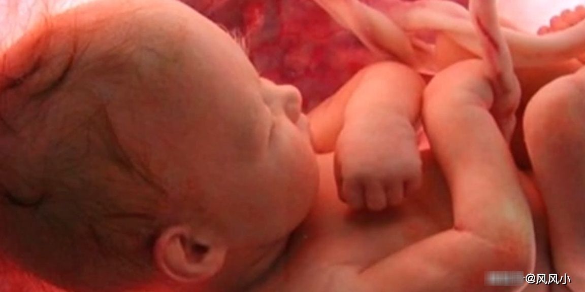 原来孕期能否顺产，B超单这项数值可能会给你个交代，很多人不懂
