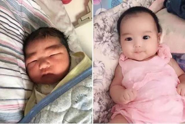 视力|还记得“丑哭宝妈”的网红宝宝吗?当初你嫌我丑,如今美到认不出