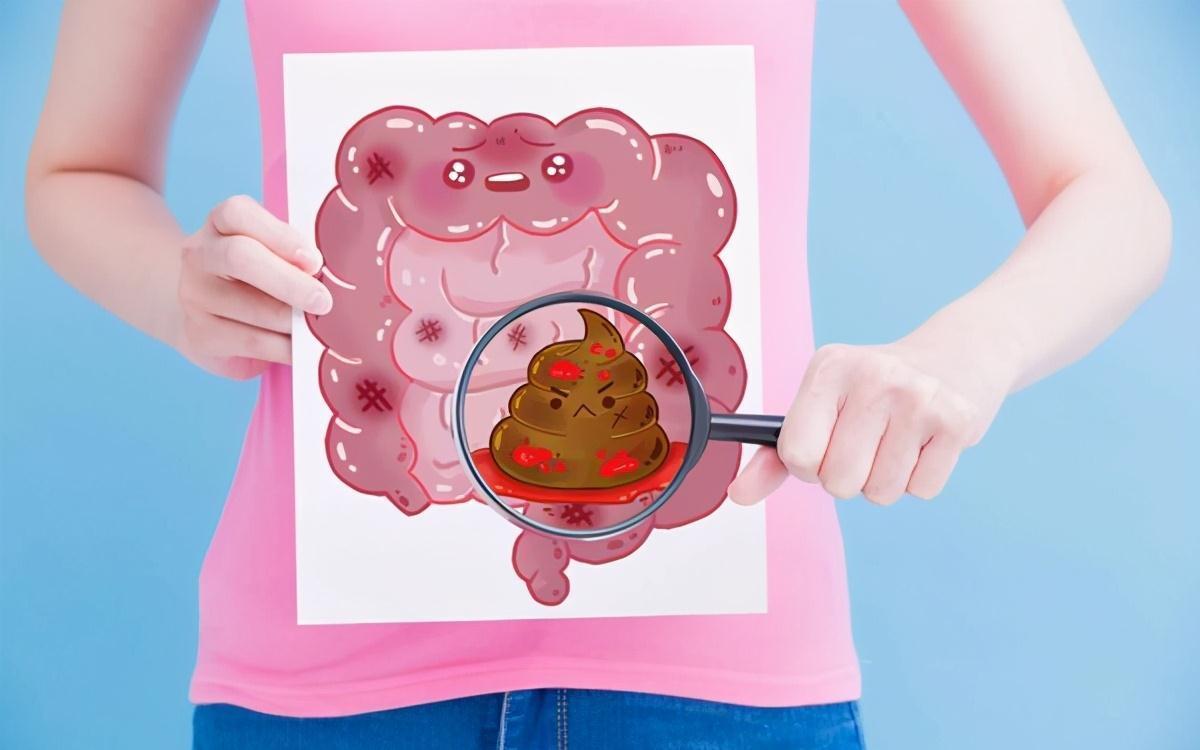 息肉|没想到！治腹泻的黄连素，还能抗肿瘤、预防息肉复发