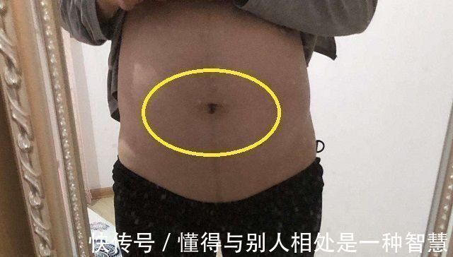 肚子|孕妈的肚脐,凸出来好还是凹进去好如果是这种状况说明很有福气