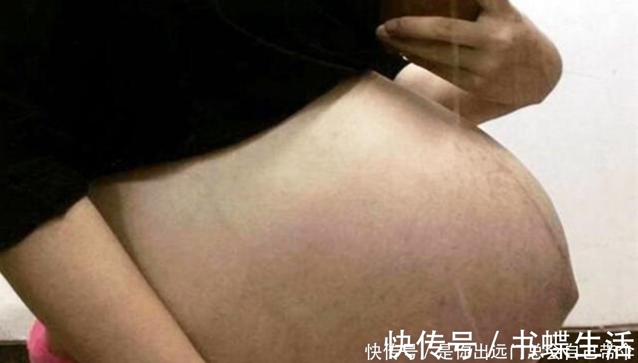 孕妇们|“悬浮肚”你见过吗?网友看完后直呼:看着都觉得疼