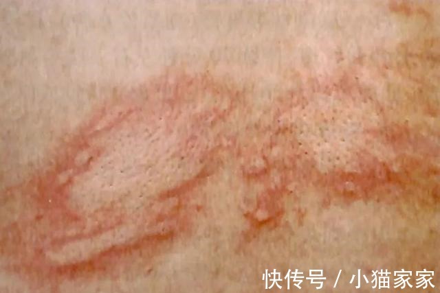 护肤品 哪些皮肤问题是护肤品不能解决的!