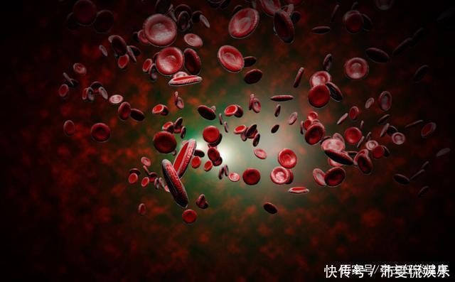 血脂升高后,这3种食物要忌口,若不注意,血管会“水泄不通”