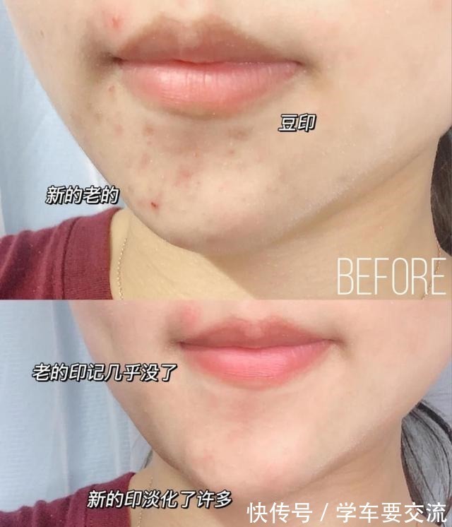 片仔癀 超市里值得买的国货护肤好物,虽然便宜,但一点不输大品牌!