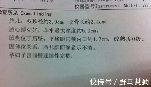 性别|产检两次都是女孩,生下的却是男孩,为啥会出现“女翻男”的情况