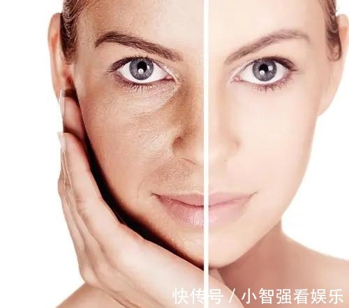 衰老|女性开始衰老的时候,脸部或有这几个表现,快来了解一下吧